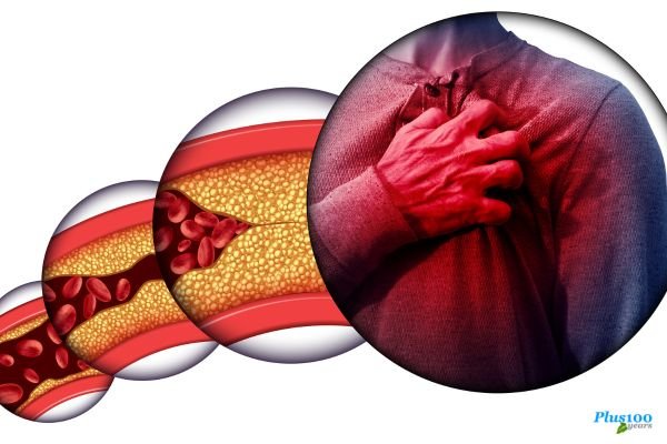 What Are Common Heart Problems
